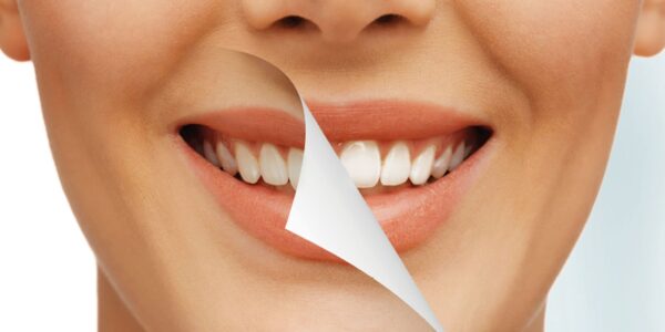 Understand the Pros and Cons of Using Crest Whitestrips in UK
