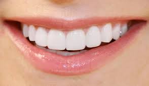 Why You Should Consider Professional Teeth Whitening
