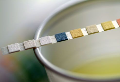 Urine test strips guide